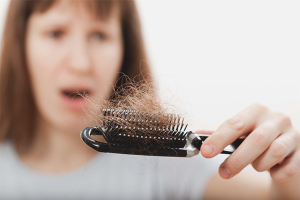  Pérdida de cabello en las mujeres.